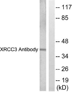 Western blot analysis of lysates from HepG2 cells, treated with Adriamycin 0.5uM 5h using Anti-XRCC3 Antibody. The right hand lane represents a negative control, where the antibody is blocked by the immunising peptide