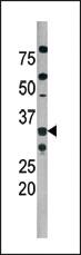 Anti-CDK2 Rabbit Polyclonal Antibody