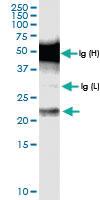 Anti-CENPN Rabbit Polyclonal Antibody