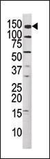 Anti-MET Rabbit Polyclonal Antibody (AP (Alkaline Phosphatase))