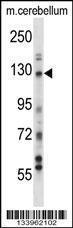 Anti-USP15 Rabbit Polyclonal Antibody (FITC (Fluorescein Isothiocyanate))