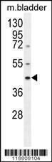 Anti-SERPINB5 Rabbit Polyclonal Antibody (Biotin)