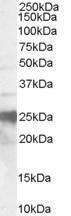 Anti-PRNP antibody