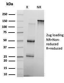 SDS-PAGE analysis of Anti-KLF17 Antibody [PCRP-KLF17-1G2] under non-reduced and reduced conditions; showing intact IgG and intact heavy and light chains, respectively. SDS-PAGE analysis confirms the integrity and purity of the antibody.