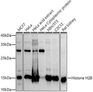 Western blot analysis of extracts of various cell lines, using Anti-Histone H2B Antibody (A305381) at 1:1,000 dilution