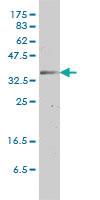 Anti-GJB3 Mouse Monoclonal Antibody [clone: 3B4-1B3]