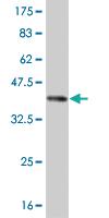 Anti-ROR2 Mouse Monoclonal Antibody [clone: 4E1]