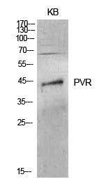 Western blot analysis of KB cells using Anti-PVR Antibody