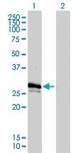 Anti-GJB3 Mouse Monoclonal Antibody [clone: 3B4-1B3]