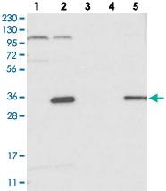 Anti-HAUS4 Rabbit Polyclonal Antibody