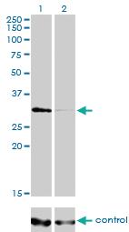 Anti-HDAC7 Mouse Monoclonal Antibody [clone: 2B11-1C1]