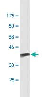 Anti-S100 A9 Mouse Monoclonal Antibody [clone: 1C22]