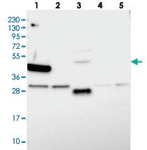 Anti-HKR1 Rabbit Polyclonal Antibody