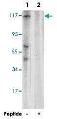 Anti-PTK2 Rabbit Polyclonal Antibody