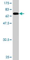 Anti-PKNOX1 Mouse Monoclonal Antibody [clone: 1F12]