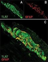 Anti-TLR7 Rabbit Polyclonal Antibody