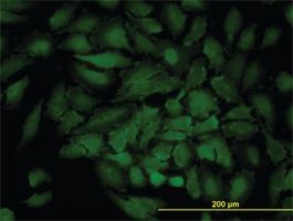 Anti-GJB3 Mouse Monoclonal Antibody [clone: 3B4-1B3]