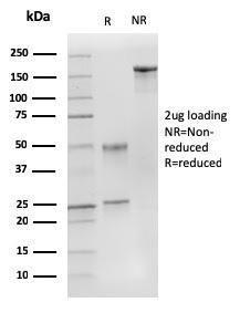 SDS-PAGE analysis of Anti-p27 KIP 1 Antibody [DCS-72.F6] under non-reduced and reduced conditions; showing intact IgG and intact heavy and light chains, respectively. SDS-PAGE analysis confirms the integrity and purity of the antibody.