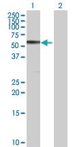 Anti-CBS Rabbit Polyclonal Antibody