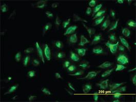 Anti-NME2 Mouse Monoclonal Antibody [clone: 1D3]