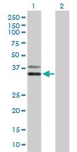 Anti-PCGF6 Mouse Polyclonal Antibody