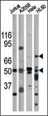 Anti-CHEK1 Rabbit Polyclonal Antibody