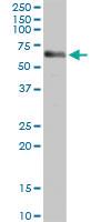 Anti-CBS Rabbit Polyclonal Antibody