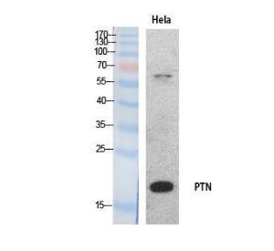 Western blot analysis of extracts from HeLa cells using Anti-PTN Antibody