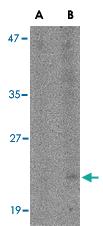 Anti-BST2 Rabbit Polyclonal Antibody