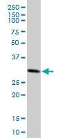 Anti-CACYBP Mouse Polyclonal Antibody