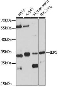 Western blot analysis of extracts of various cell lines, using Anti-IER5 Antibody (A305383) at 1:1,000 dilution