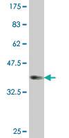 Anti-PTCH1 Mouse Monoclonal Antibody [clone: 3B3]