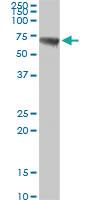 Anti-CBS Rabbit Polyclonal Antibody