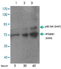 Anti-RPS6KB1 Rabbit Polyclonal Antibody