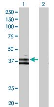 Anti-WNT6 Rabbit Polyclonal Antibody