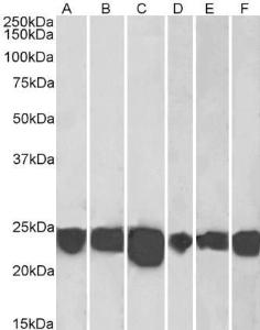 Anti-PARK7 Antibody (A83672) (0.001 µg/ml) staining of Human Cerebellum (A), Human Frontal Cortex (B), Human Hippocampus (C) Mouse Fetal Brain (D), Mouse Brain (E) and Rat Brain (F) lysates (35 µg protein in RIPA buffer). Detected by chemiluminescence