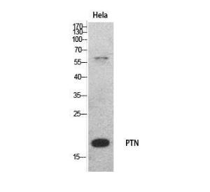 Western blot analysis of HeLa cells using Anti-PTN Antibody