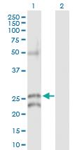 Anti-GJB5 Rabbit Polyclonal Antibody