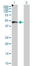 Anti-EFEMP2 Rabbit Polyclonal Antibody