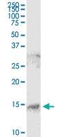 Anti-S100 A9 Antibody Pair