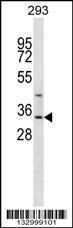 Anti-GLYAT Rabbit Polyclonal Antibody (HRP (Horseradish Peroxidase))