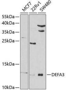 Anti-HP-3 Rabbit Polyclonal Antibody