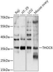 Anti-THOC6 Rabbit Polyclonal Antibody