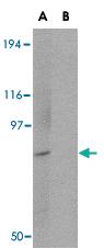 Anti-BICD1 Rabbit Polyclonal Antibody