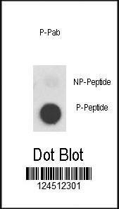 Anti-MET Rabbit Polyclonal Antibody (HRP (Horseradish Peroxidase))