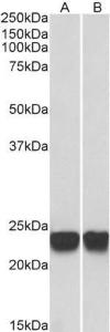 Anti-PARK7 Antibody (A83672) (0.001 µg/ml) staining of HeLa (A) and Jurkat (B) lysates (35 µg protein in RIPA buffer). Detected by chemiluminescence