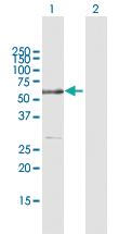 Anti-RAD23B Mouse Polyclonal Antibody