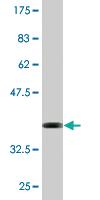 Anti-HMGA2 Mouse Monoclonal Antibody [clone: 1D8]