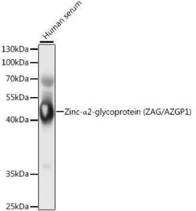 Western blot analysis of extracts of human serum, using Anti-Zinc Alpha 2 Glycoprotein Antibody (A9703) at 1:1000 dilution