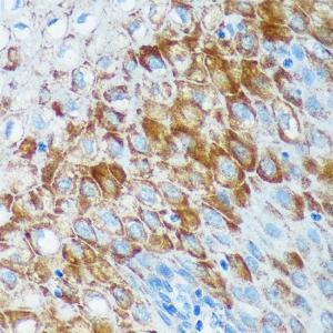 Immunohistochemistry analysis of paraffin-embedded human esophageal using Anti-IER5 Antibody (A305383) at a dilution of 1:100 (40X lens). Perform microwave antigen retrieval with 10 mM PBS buffer pH 7.2 before commencing with IHC staining protocol